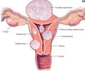 Help Me Fibroids Herbal  image 0