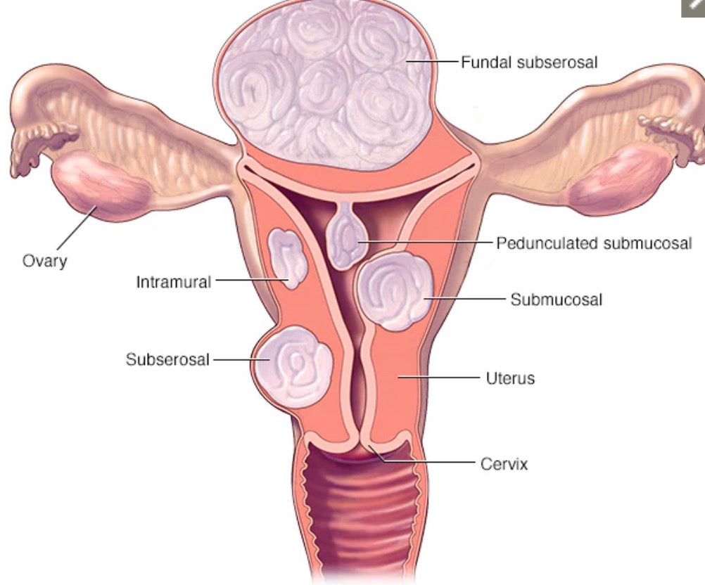Help Me Fibroids Herbal  image 0